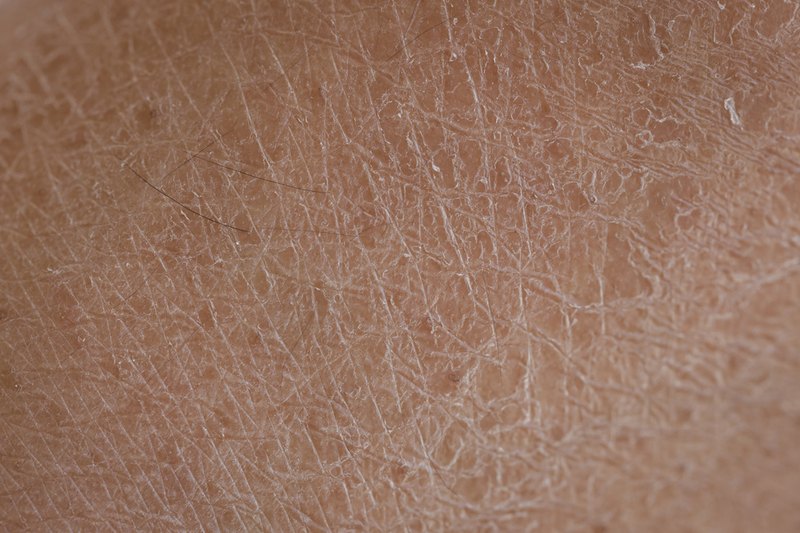 Close-up of dry skin texture